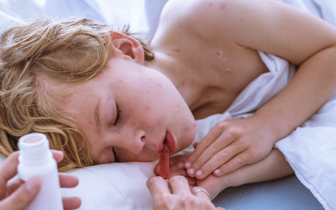 Eritema Infeccioso ou Quinta Moléstia